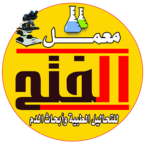 معامل الفتح